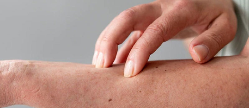 skin-diseases-allergies-treatment